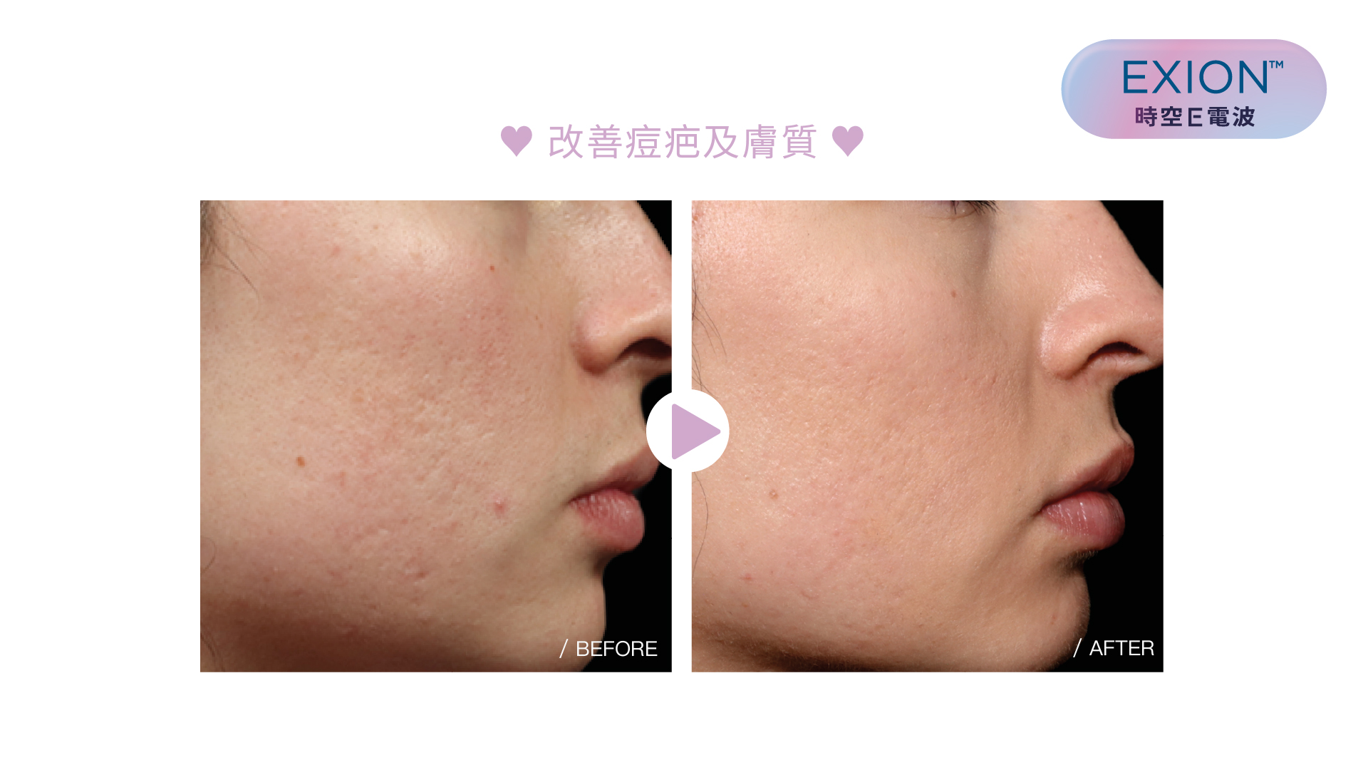 EXION 時空E電波
