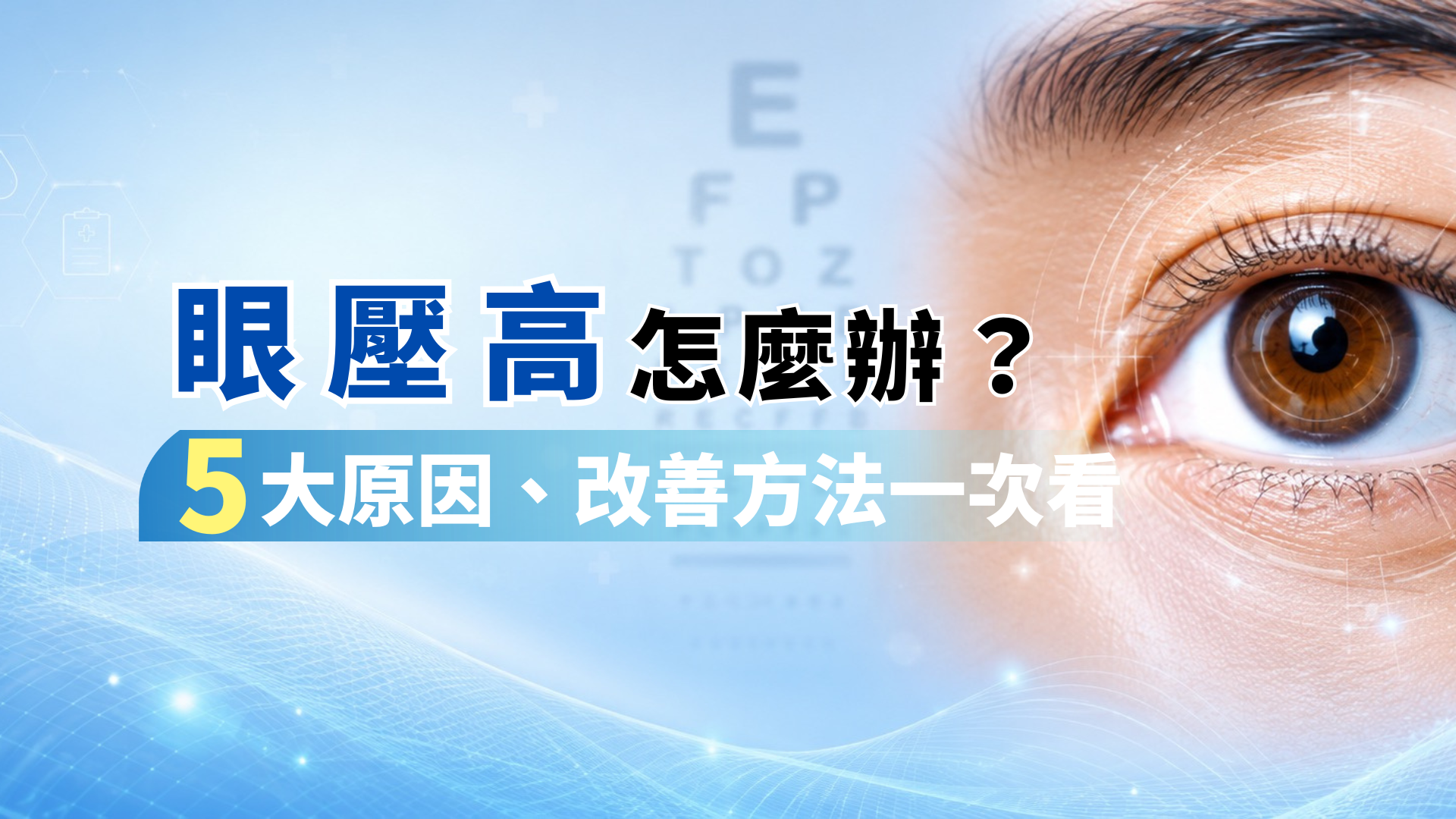 眼壓高怎麼辦?5大原因、改善方法一次看