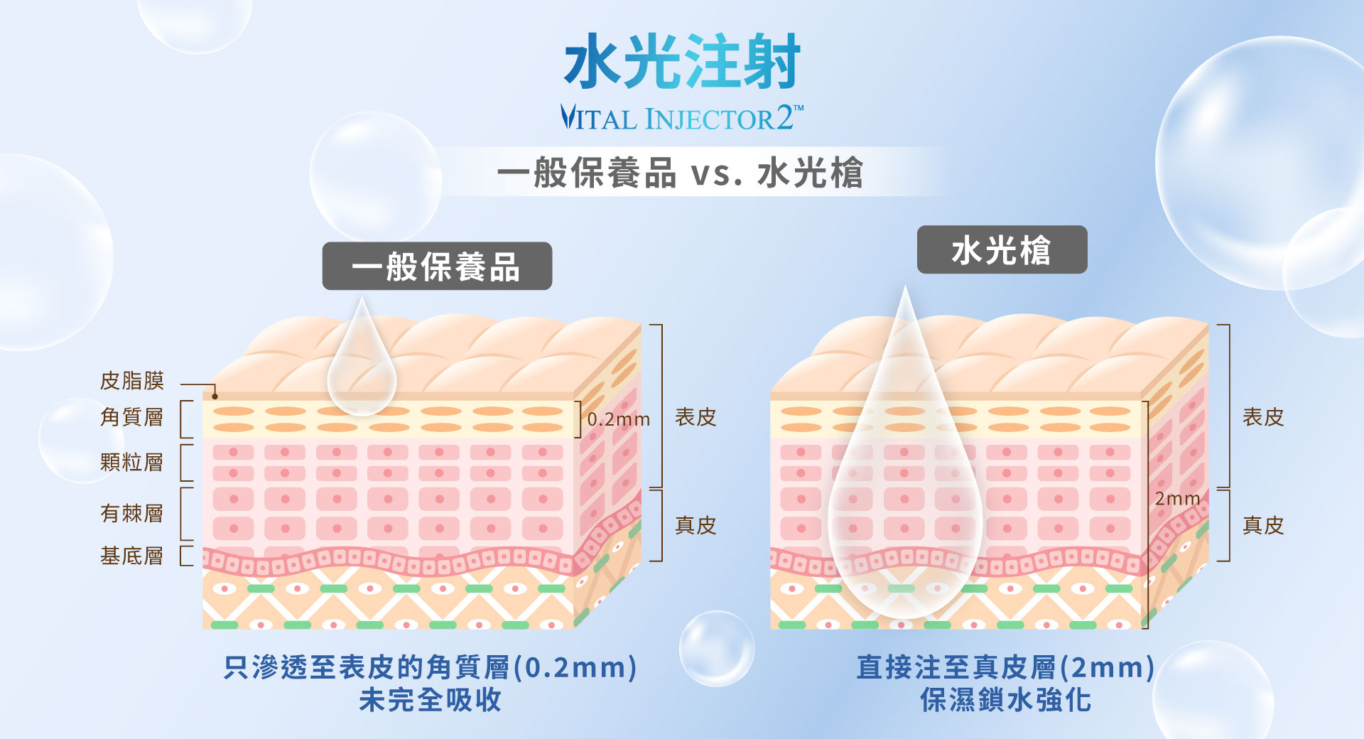 解除肌荒警報!水光槍是什麼?深入了解水光針的補水原理與適合族群