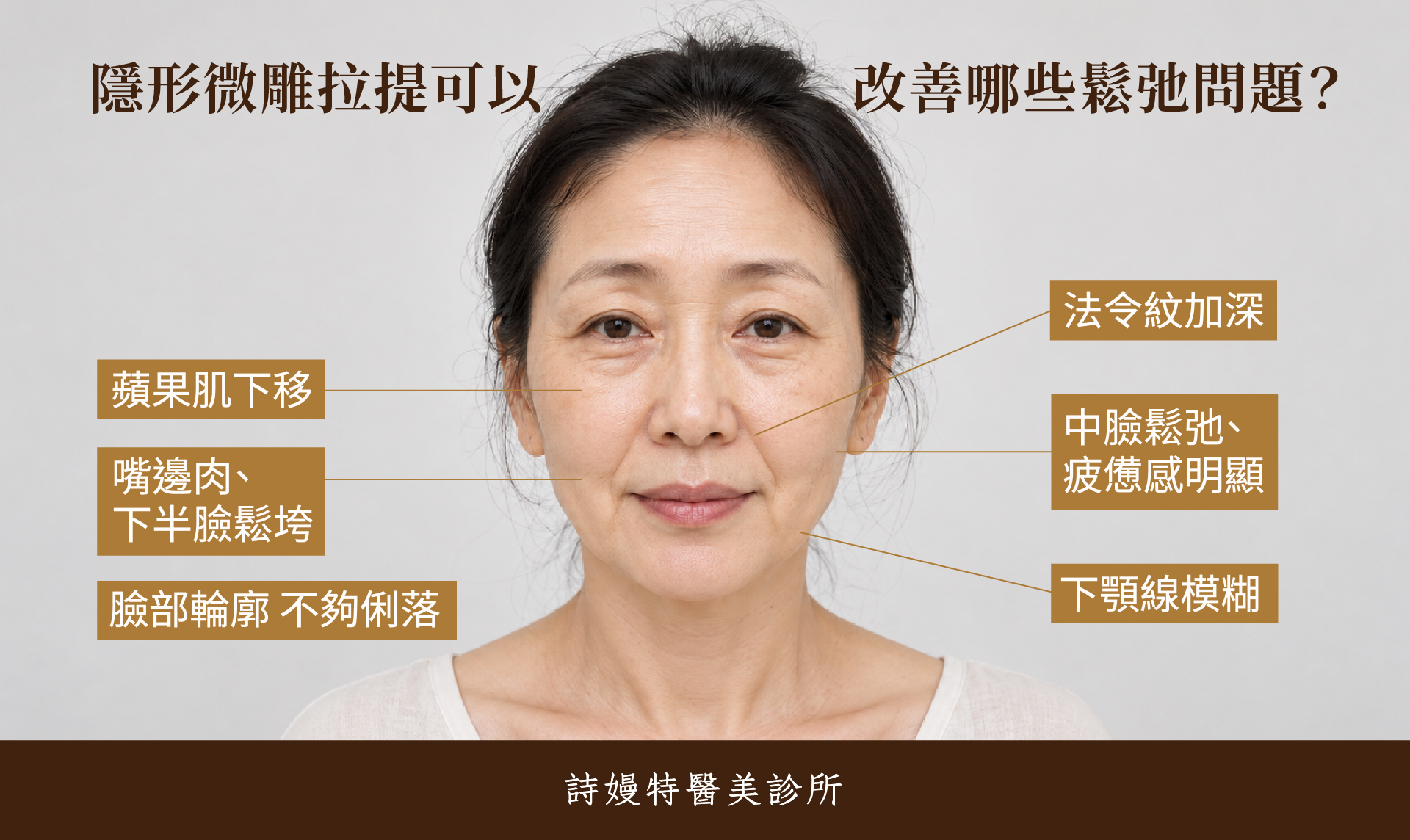 隱形微雕拉提