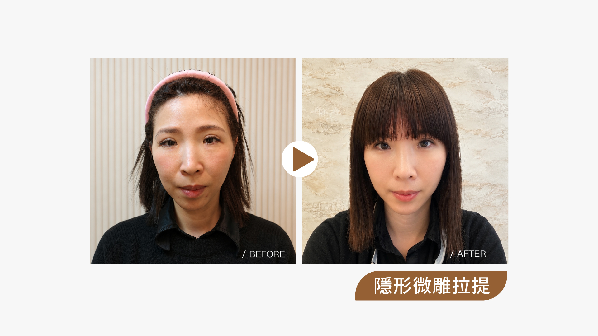 隱形微雕拉提