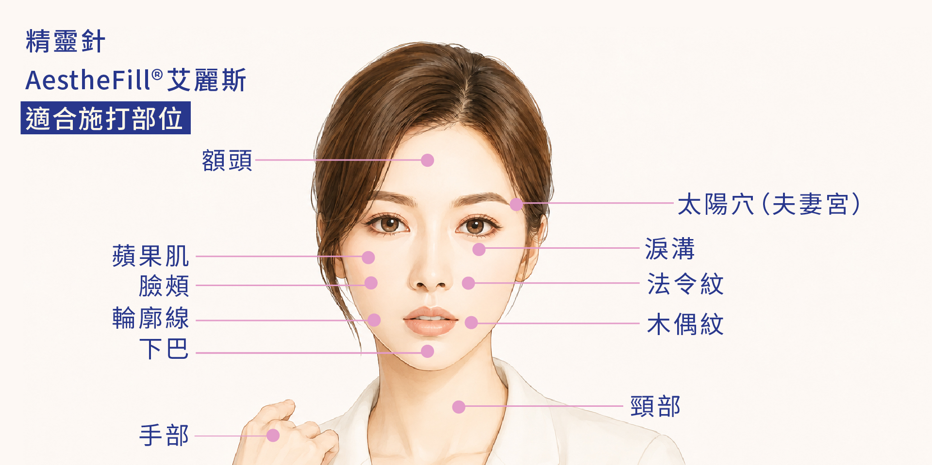 精靈針