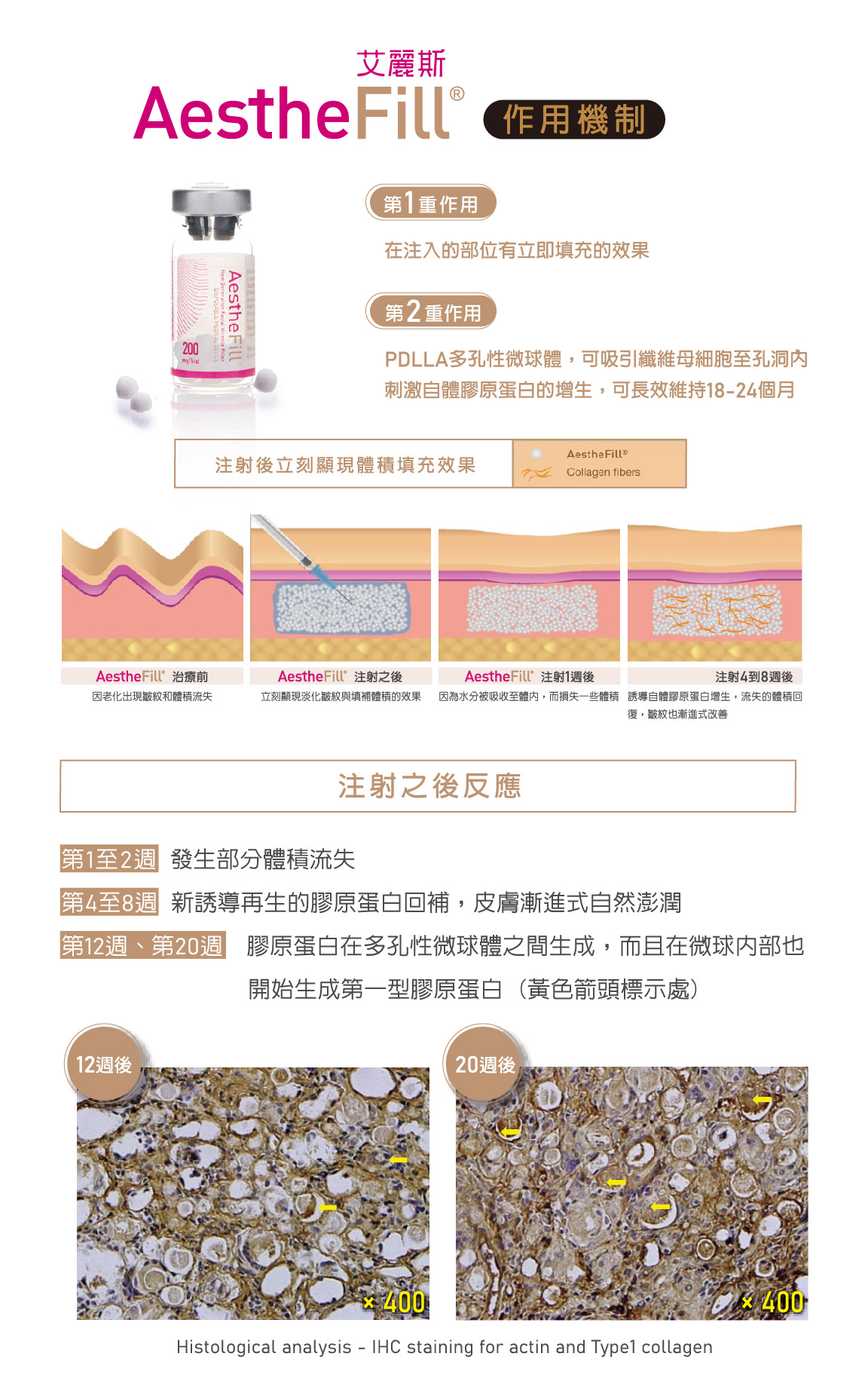 精靈針