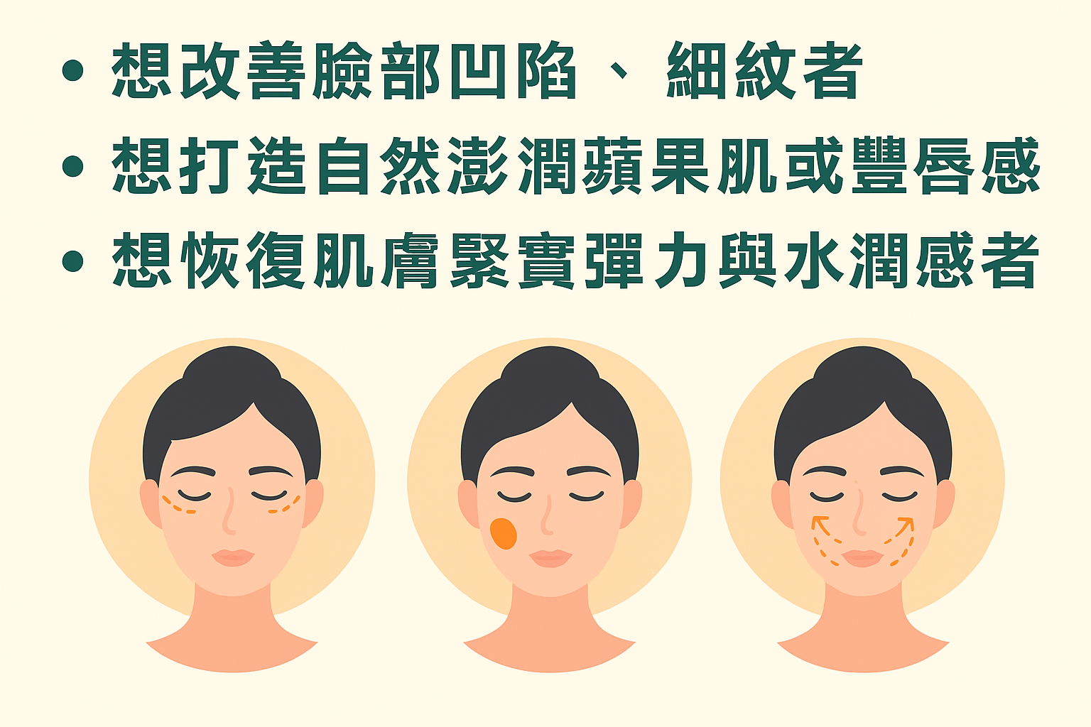 仙女玻尿酸
