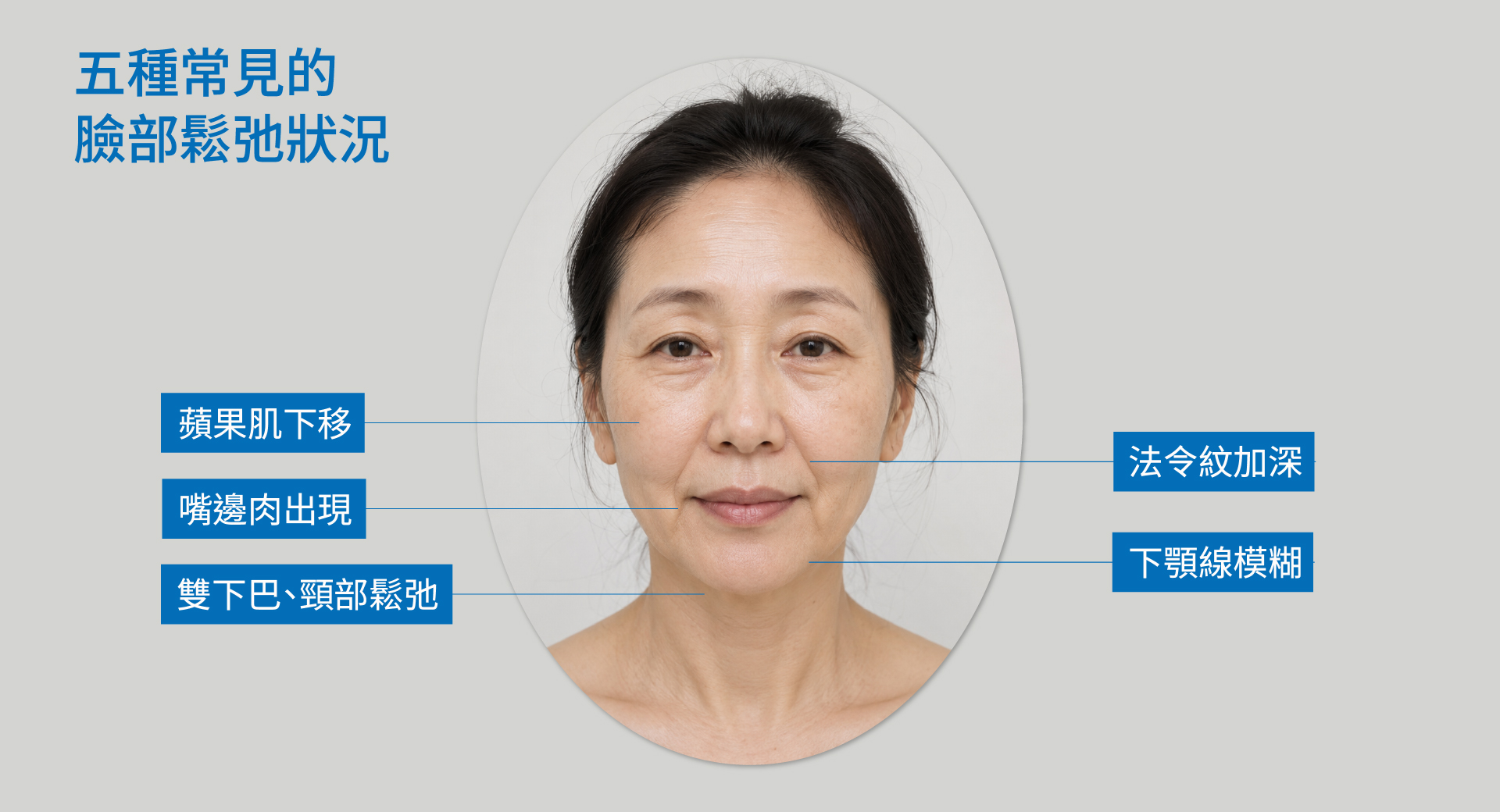 無痕筋膜拉提(線雕)適合誰？5種常見臉部鬆弛狀況一次看