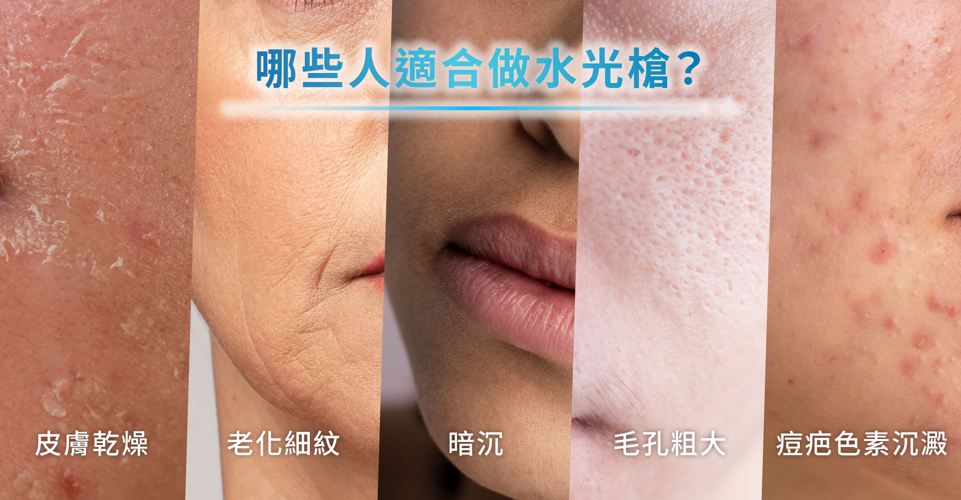 解除肌荒警報！水光槍是什麼？深入了解水光針的補水原理與適合族群