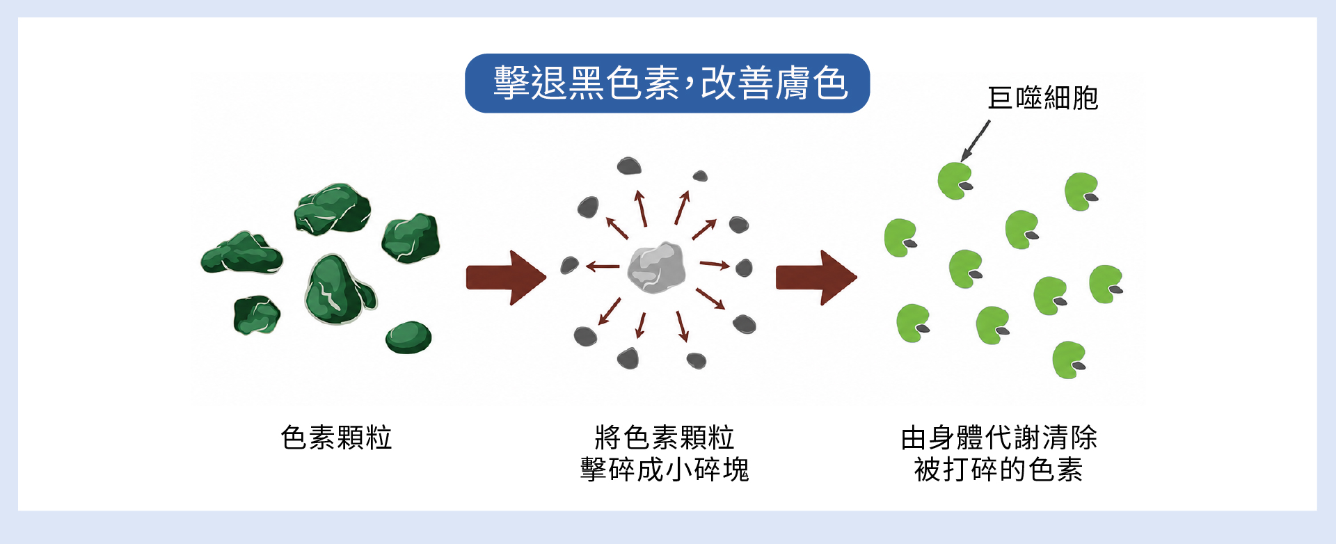 光繞雷射