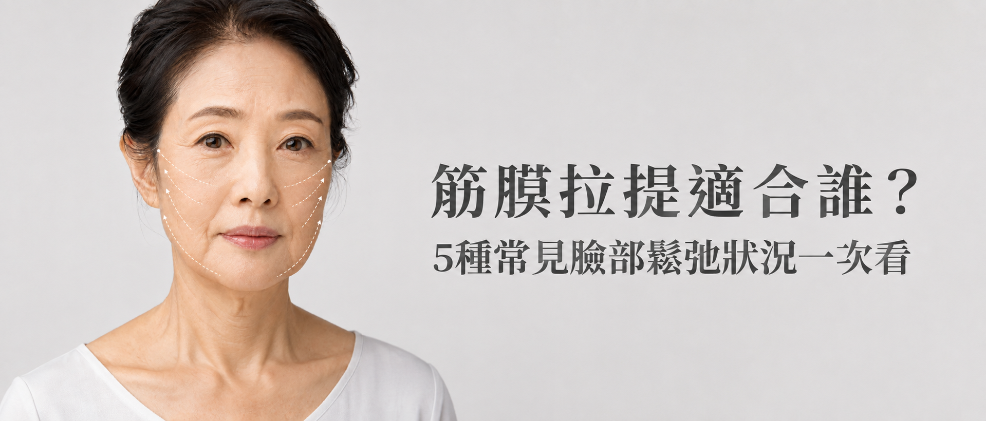 無痕筋膜拉提(線雕)適合誰?5種常見臉部鬆弛狀況一次看