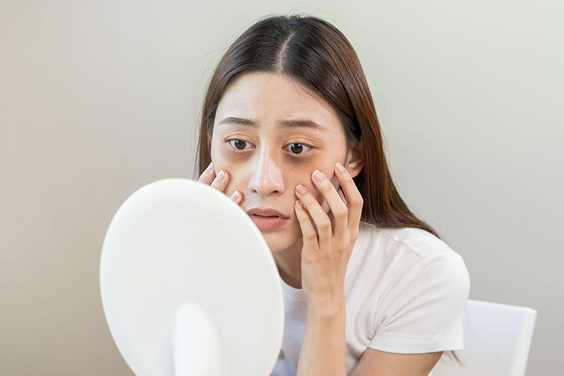 惱人的眼周細紋透露年齡 對抗老態你還可以這麼做？