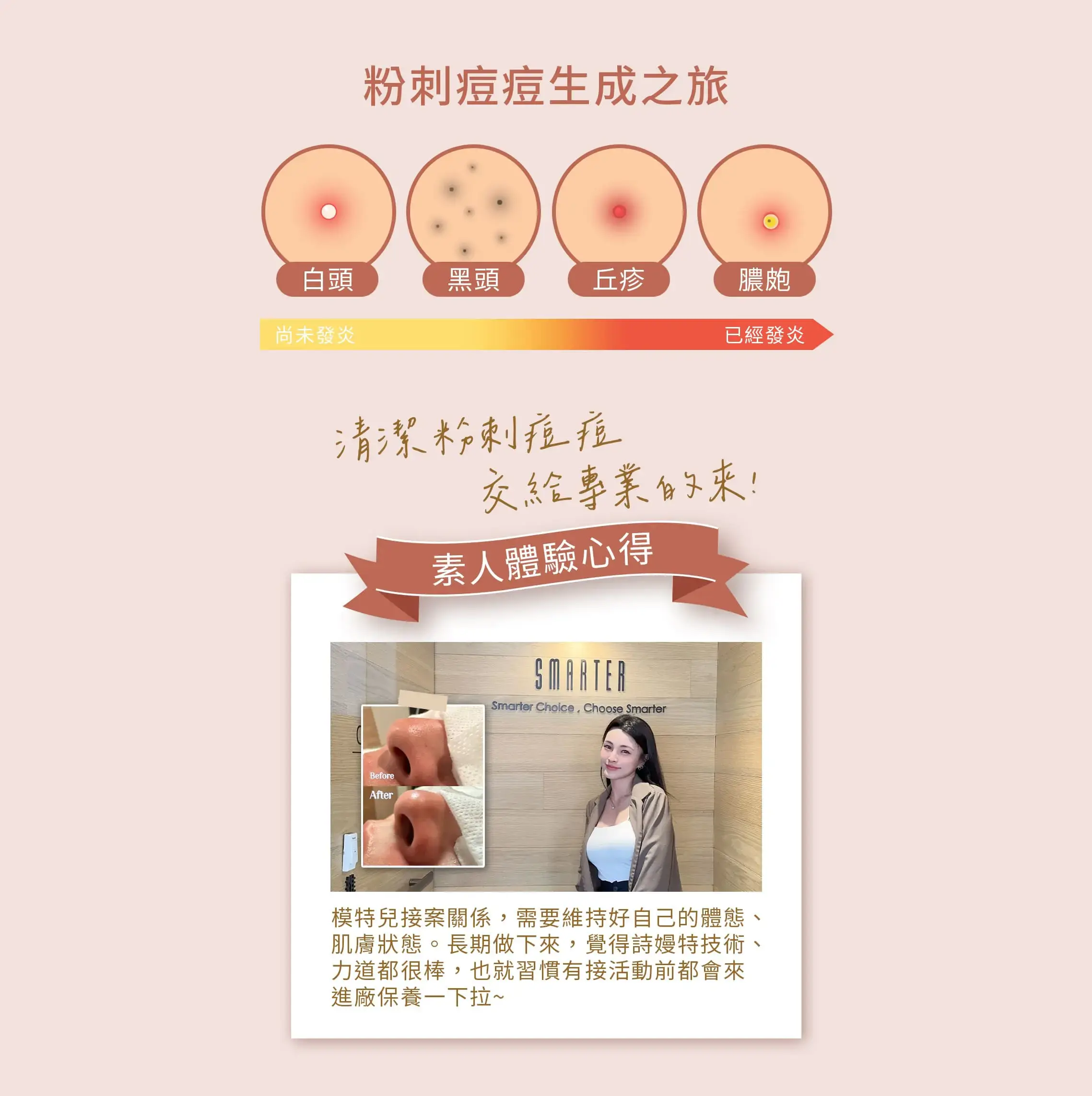 臉部救援 戰痘開始！杜鵑淨顏美肌 #粉刺痘痘不要鬧 #擺脫草莓鼻｜杜鵑淨顏美肌