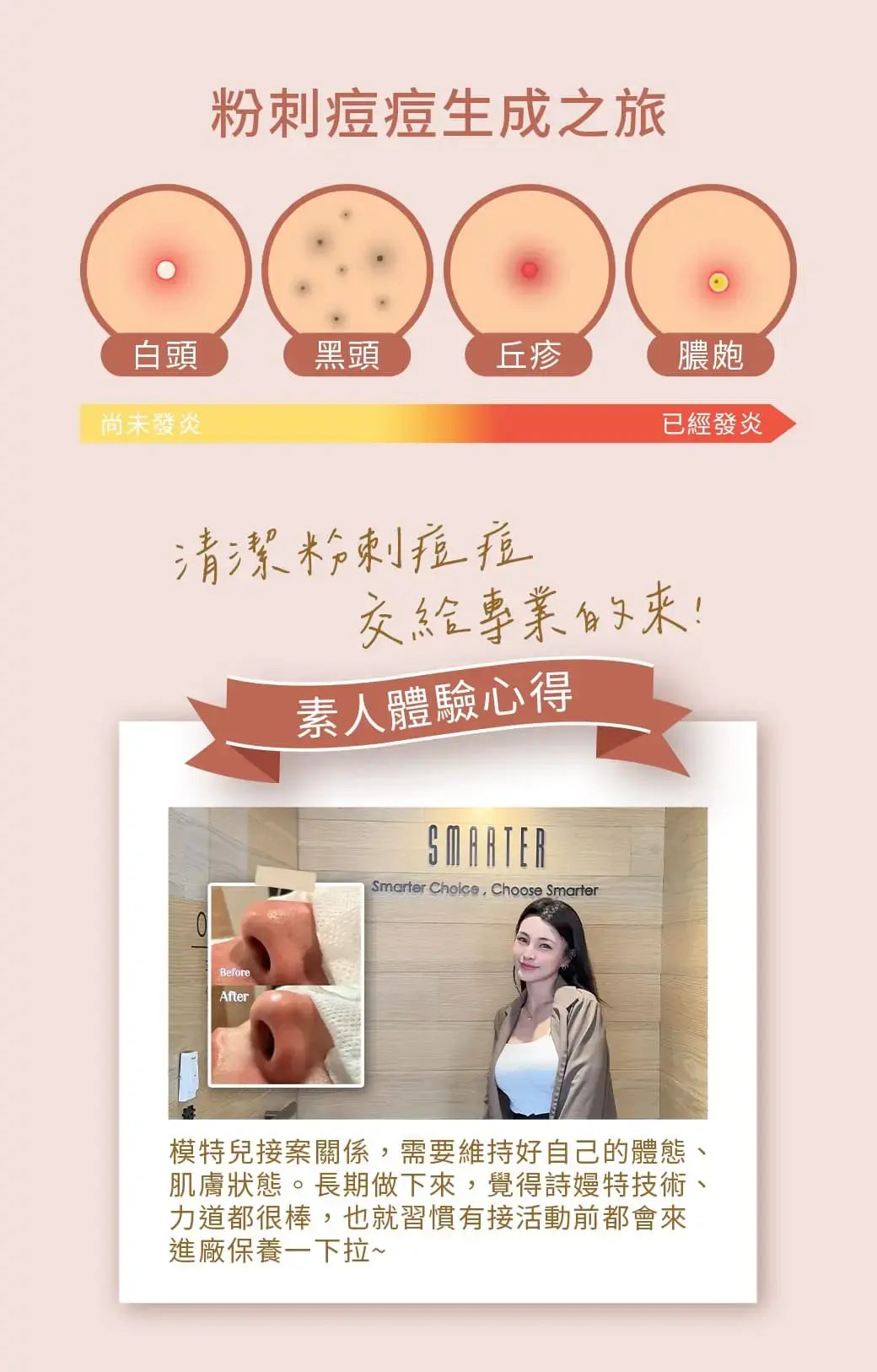 臉部救援 戰痘開始！杜鵑淨顏美肌 #粉刺痘痘不要鬧 #擺脫草莓鼻｜杜鵑淨顏美肌