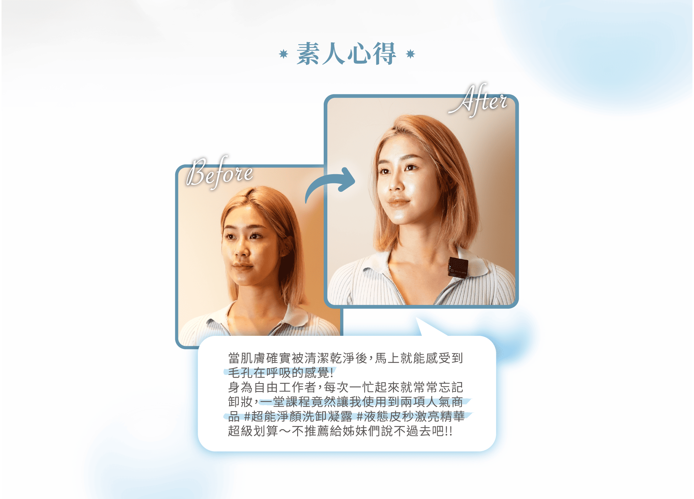皮秒激亮修護;#提亮膚色#深層補水#淡斑代謝;14天有感！痘痘、粉刺、暗沈、毛孔粗大、老化、細紋｜皮秒激亮修護